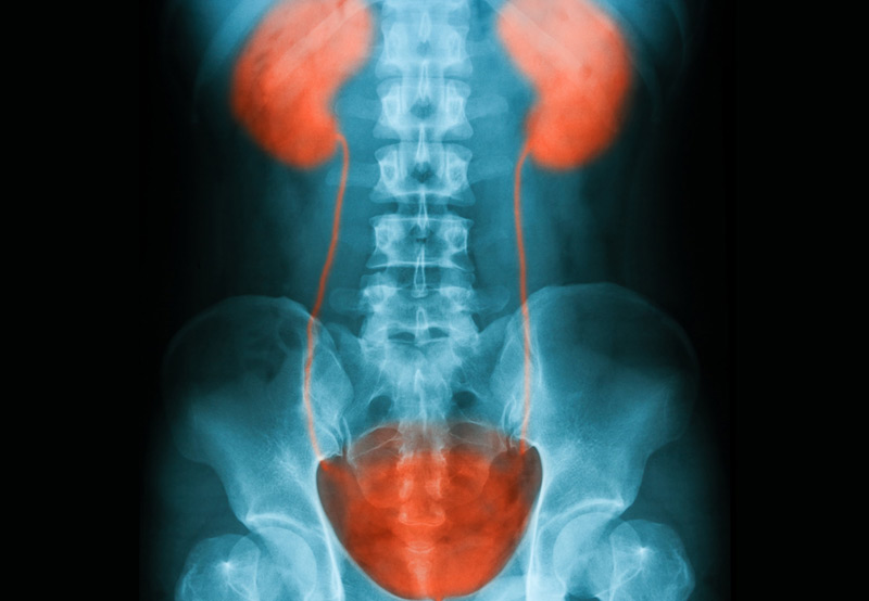 x-ray-of-bladder-related-to-urinary-incontinence-Dr.-Ross-Moskowitz
